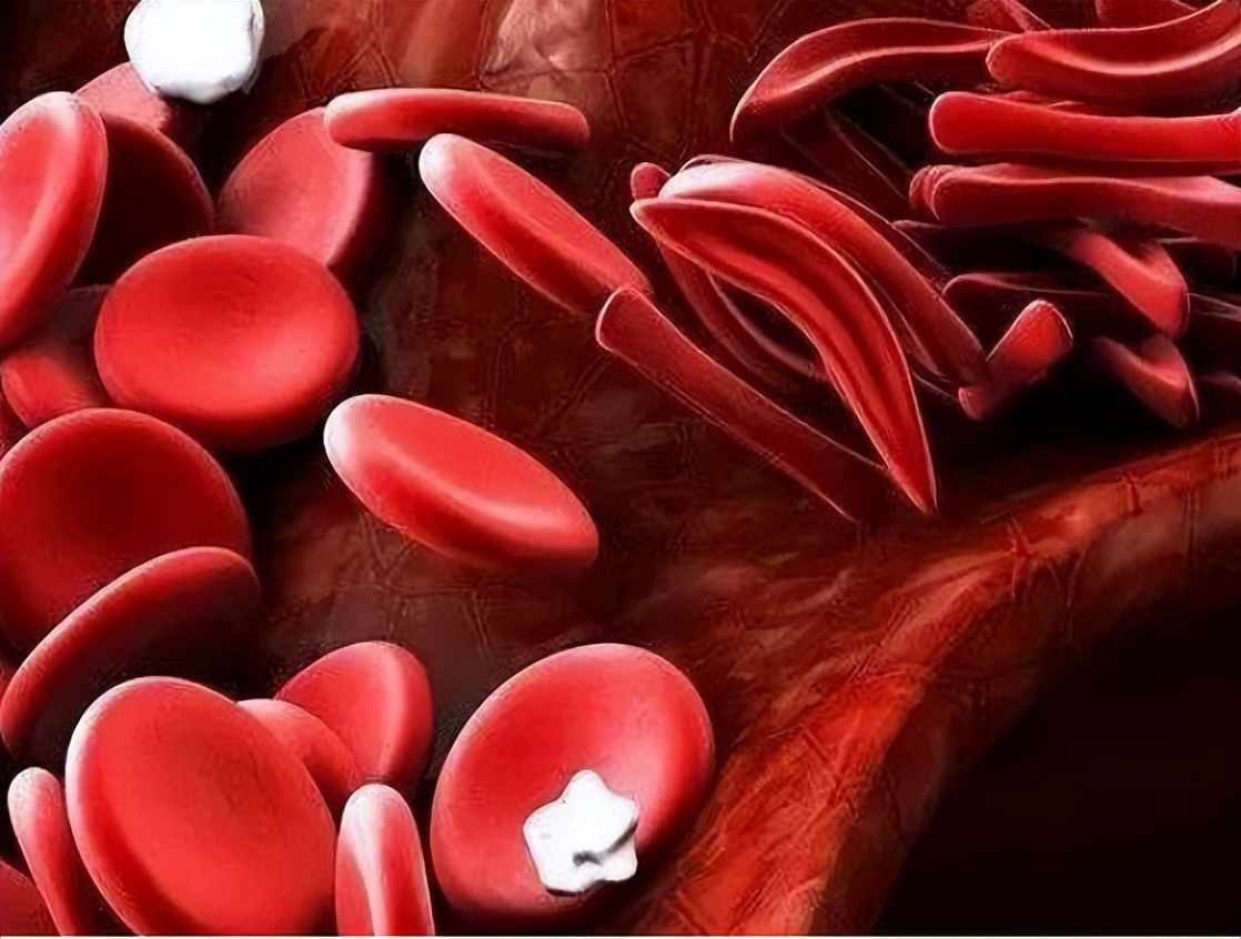 长期吃硝苯地平5个问题要清楚,长期吃硝苯地平4个细节要清楚