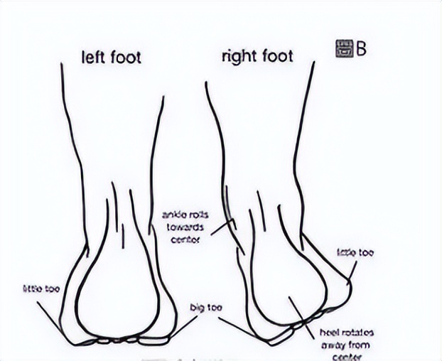 个人怎么判断跟骨内翻,如何诊断前足内翻