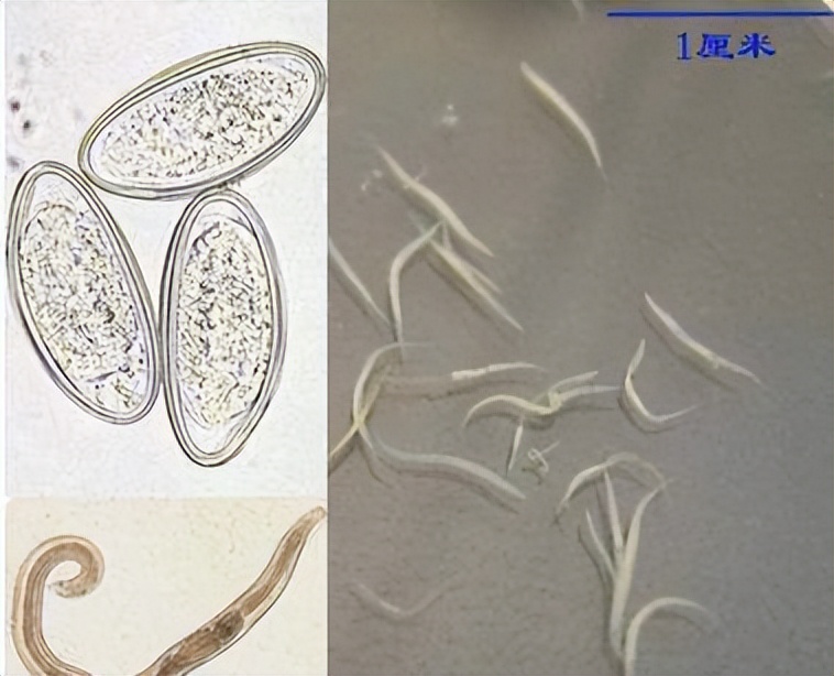 宝宝睡觉不停抠屁屁，宝爸宝妈注意了，可能感染寄生虫