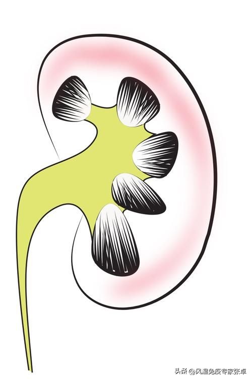 痛风清热解毒方法,一物治好痛风的方法