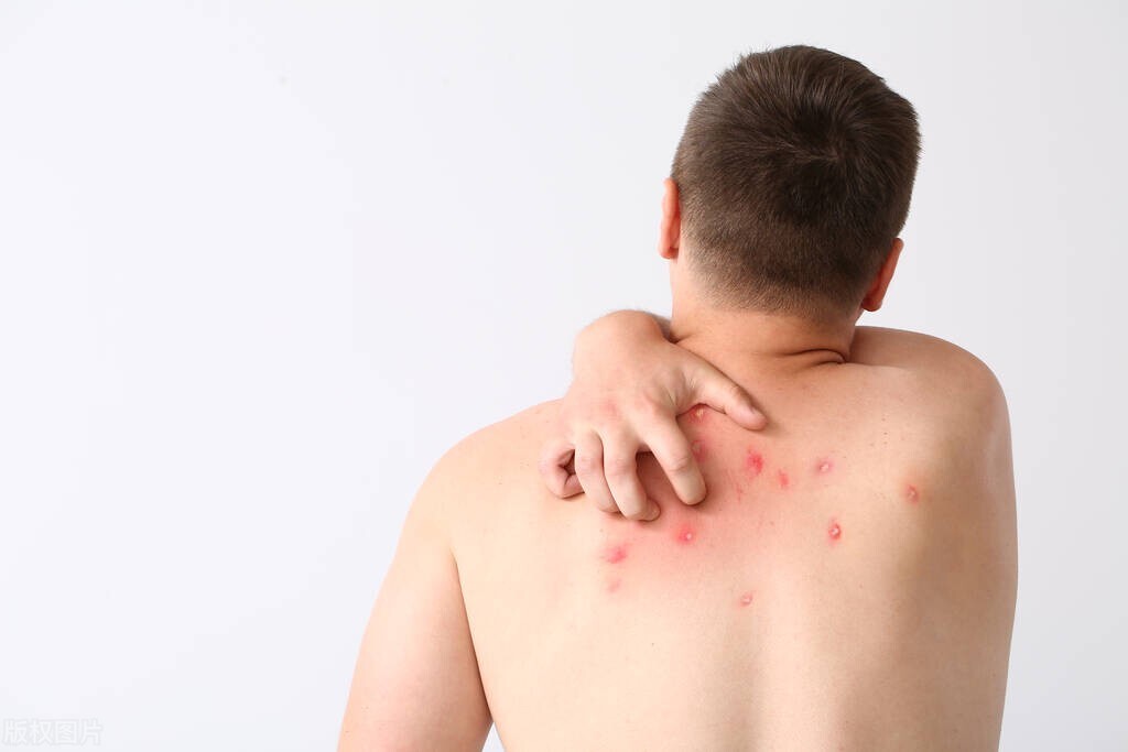 脸上长痘痘以后长肿瘤几率高吗,怎么判断是痘痘还是皮肤肿瘤