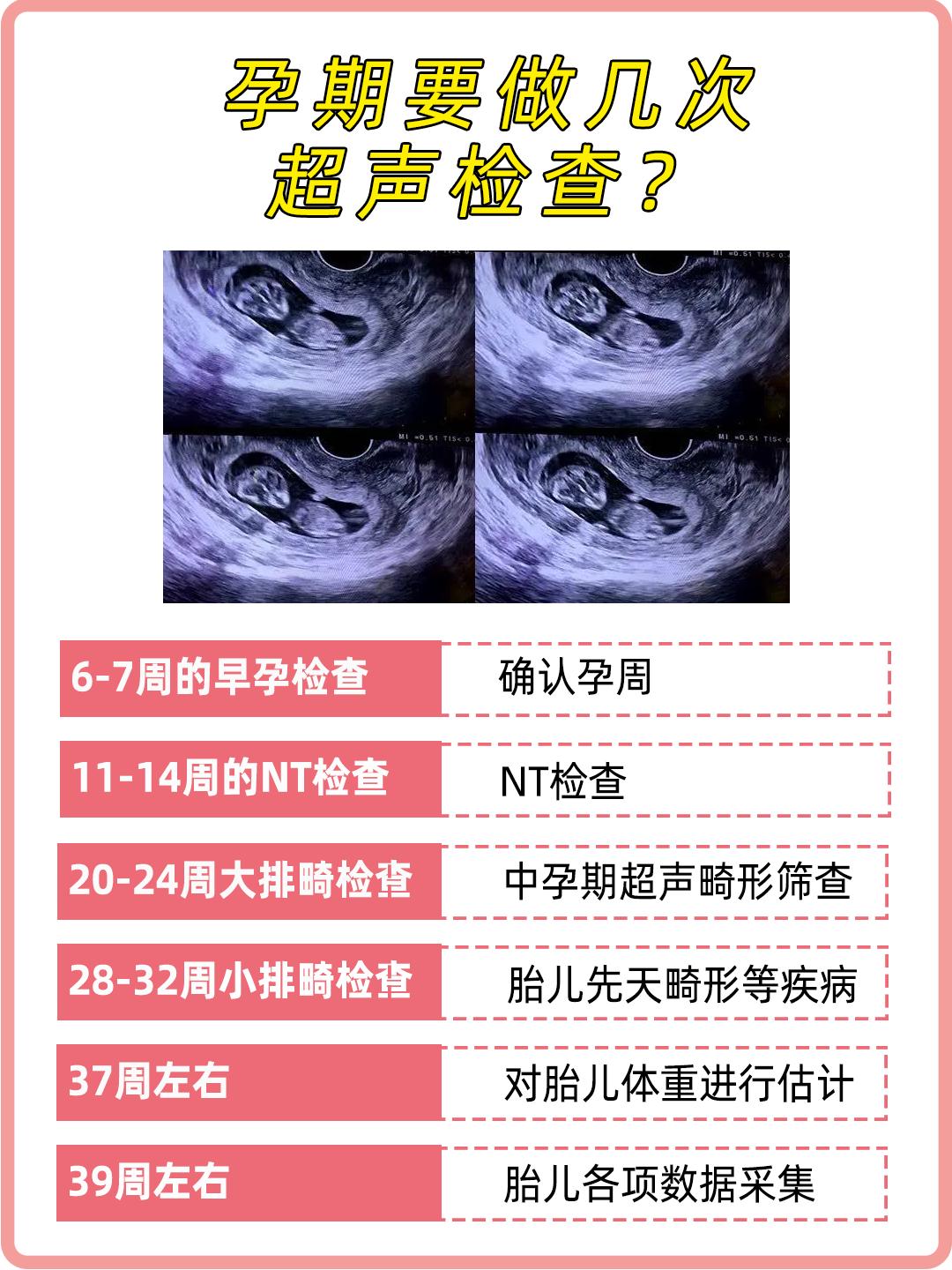 孕期最多能做几次b超,孕期需要做几次b超检查