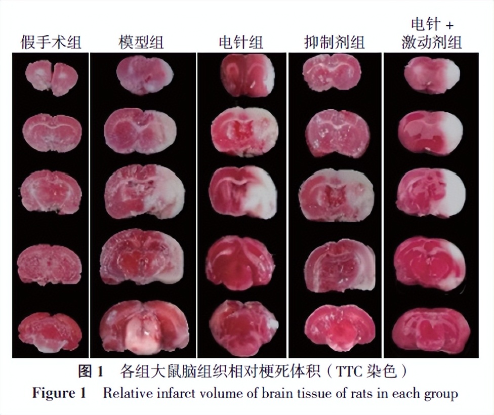 通督调神,通督调神盘龙针