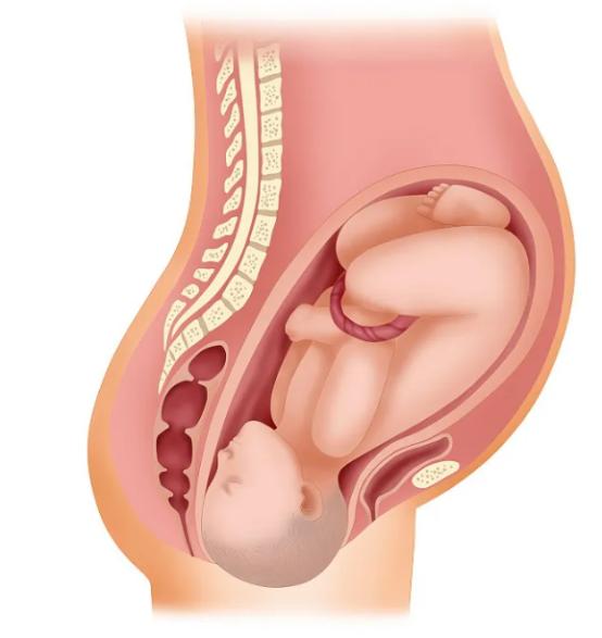 一次生十个孩子的妈妈现在怎么样,一次怀孕有多难