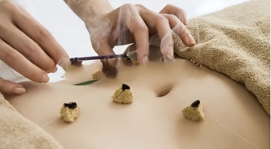 马氏温灸法最后灸肚脐,马氏温灸法治疗肾炎