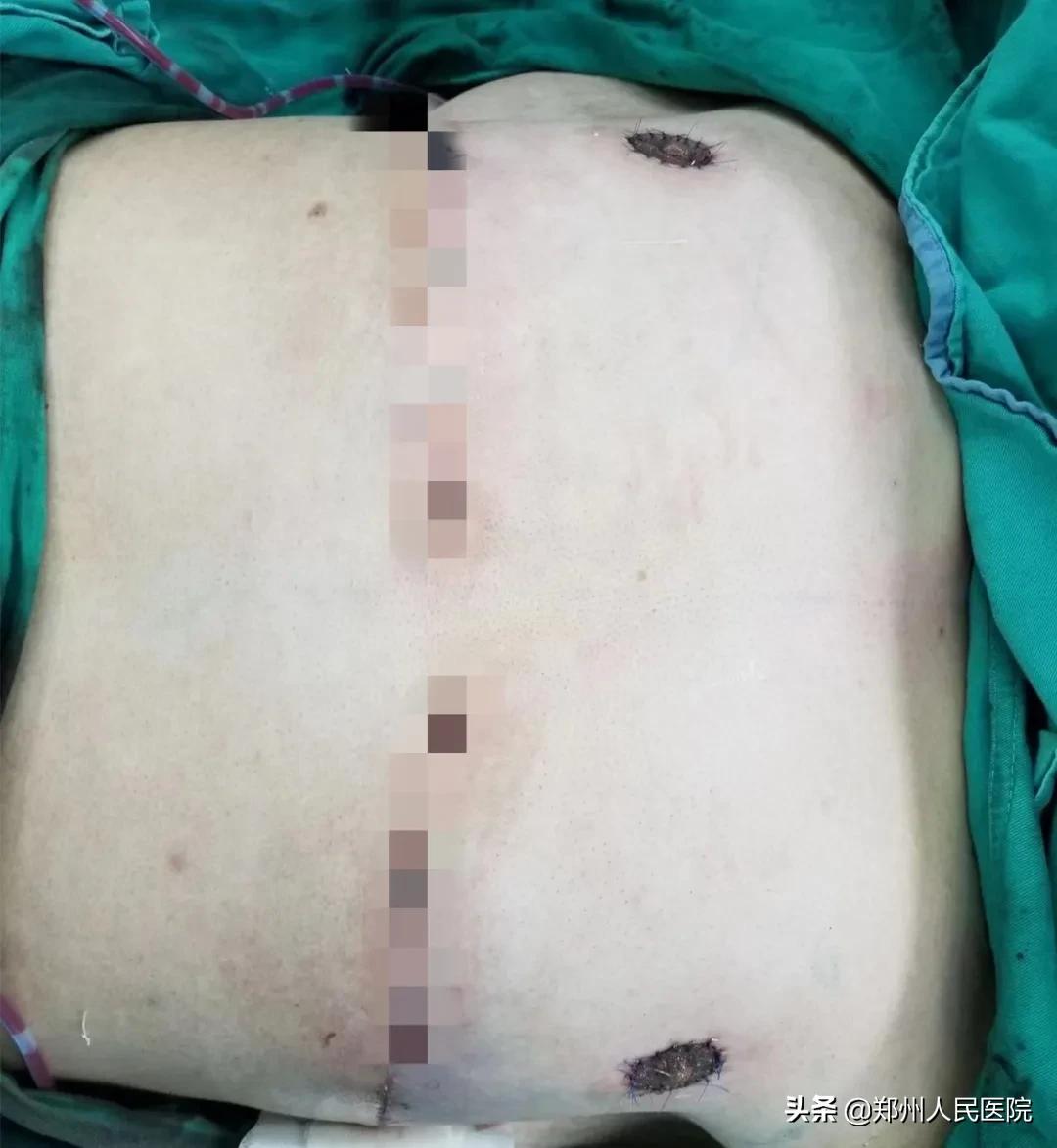 210斤肌肉男减肥成功案例,30斤胖小伙减肥成功变帅气