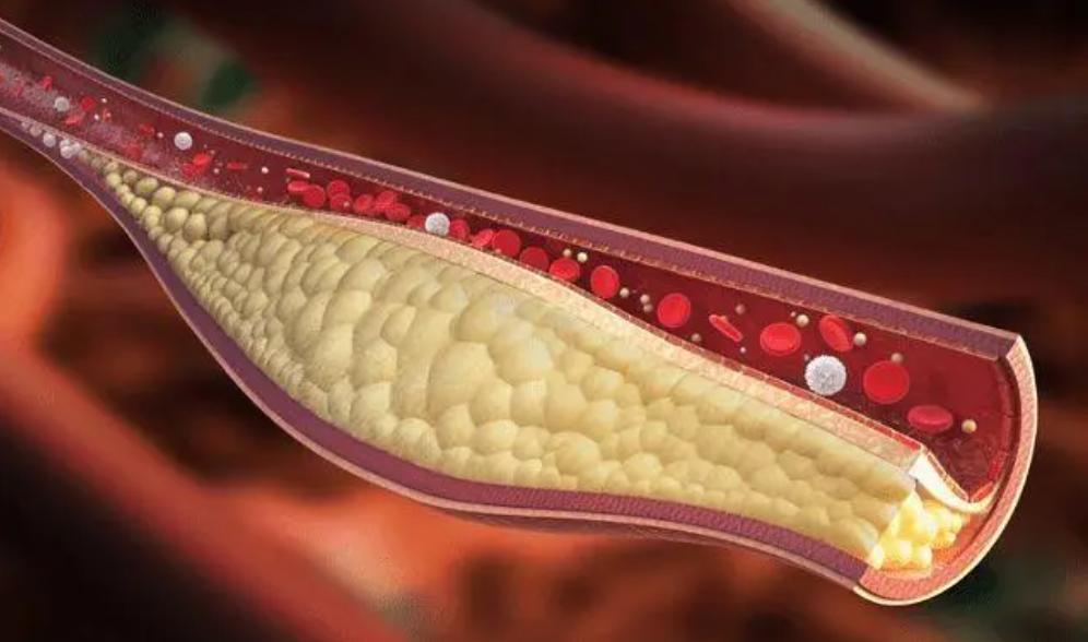 治疗阳痿的维生素,治疗阳痿缺哪种营养