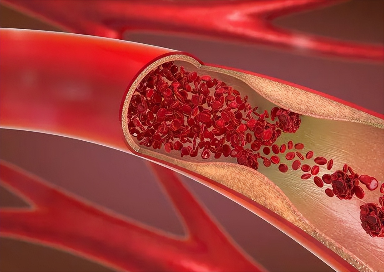 冬天来了皮肤干燥脱衣服有皮屑,一到冬天皮肤干燥掉皮屑像下雪