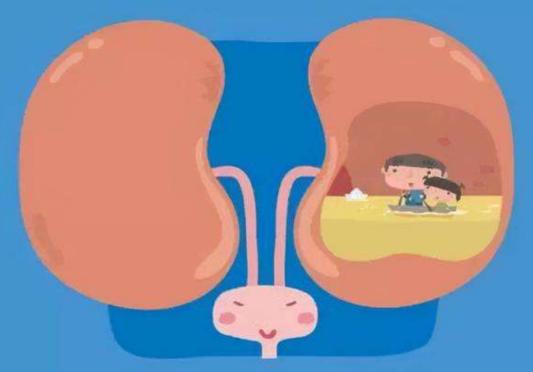 肾脏多尿,多尿跟糖尿病有关吗