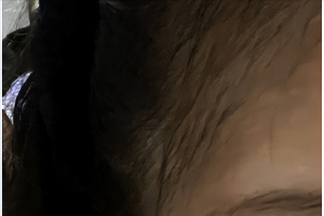 米诺地尔长头发的原理,用米诺地尔能长头发吗