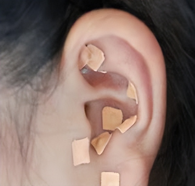 妇科最好的中医治疗方法,中国现在治疗妇科最好的中医