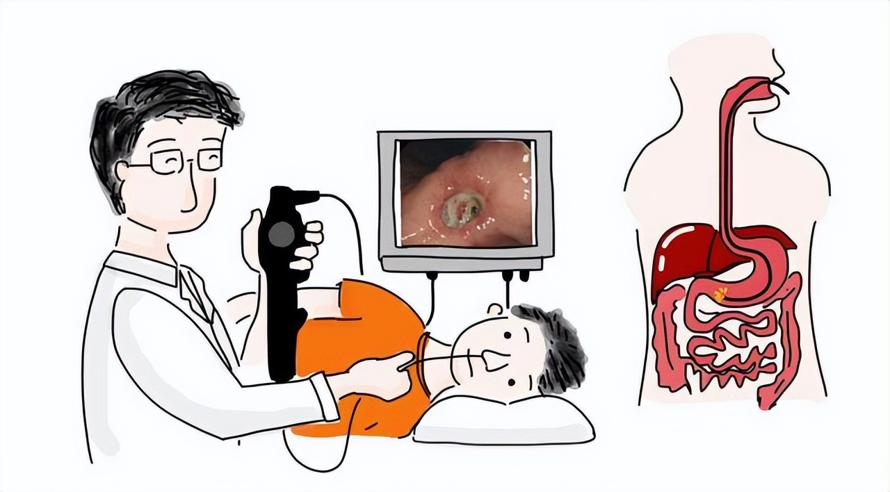 无痛胃镜与普通胃镜的区别是什么,无痛胃镜和普通胃镜区别在哪