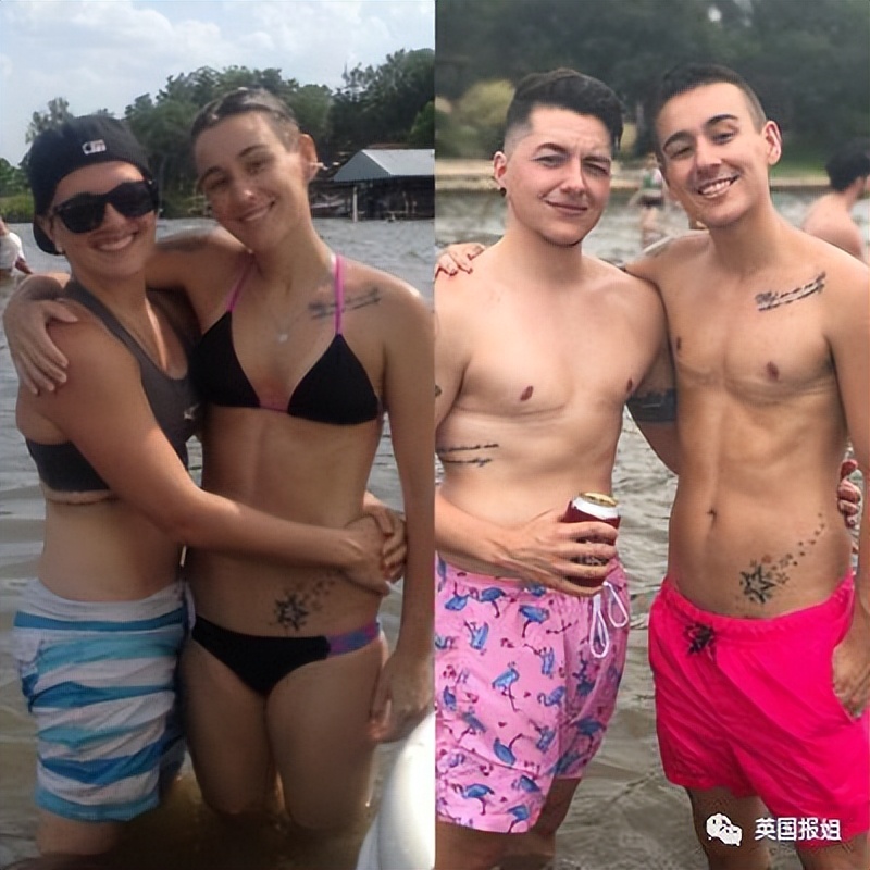 一男子为了变性为女生,竟然用鱼皮造了*体下**