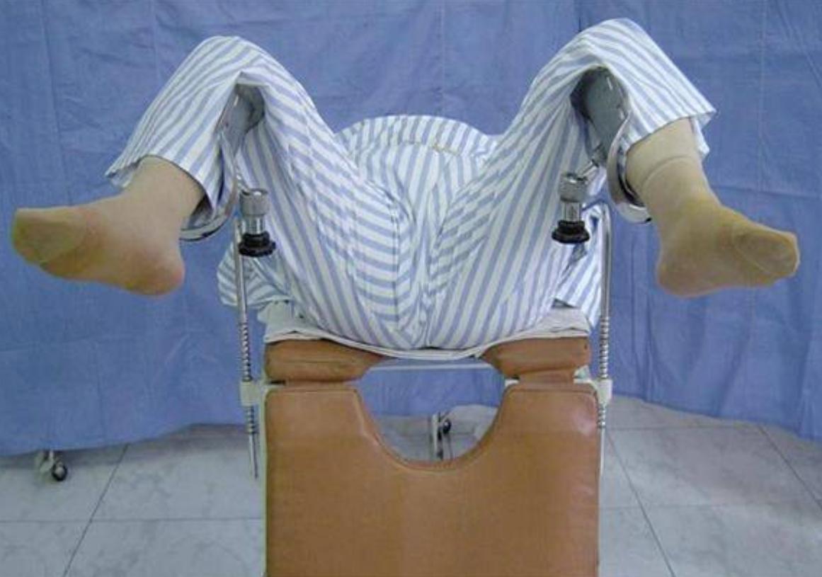 妇科内窥镜检查医生视角,妇科检查医生眼睛视角