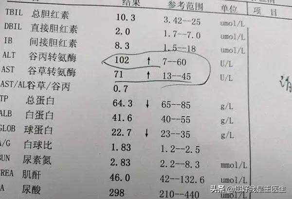 体检报告上哪个指标是转氨酶,体检报告中转氨酰肽酶高