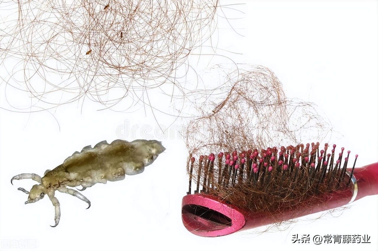 虱子和虮子,虱子和虱子有什么不同