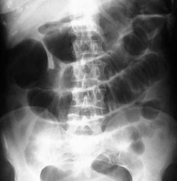 叶向真回忆父亲*剑英叶**：为陈毅病情拍桌发怒