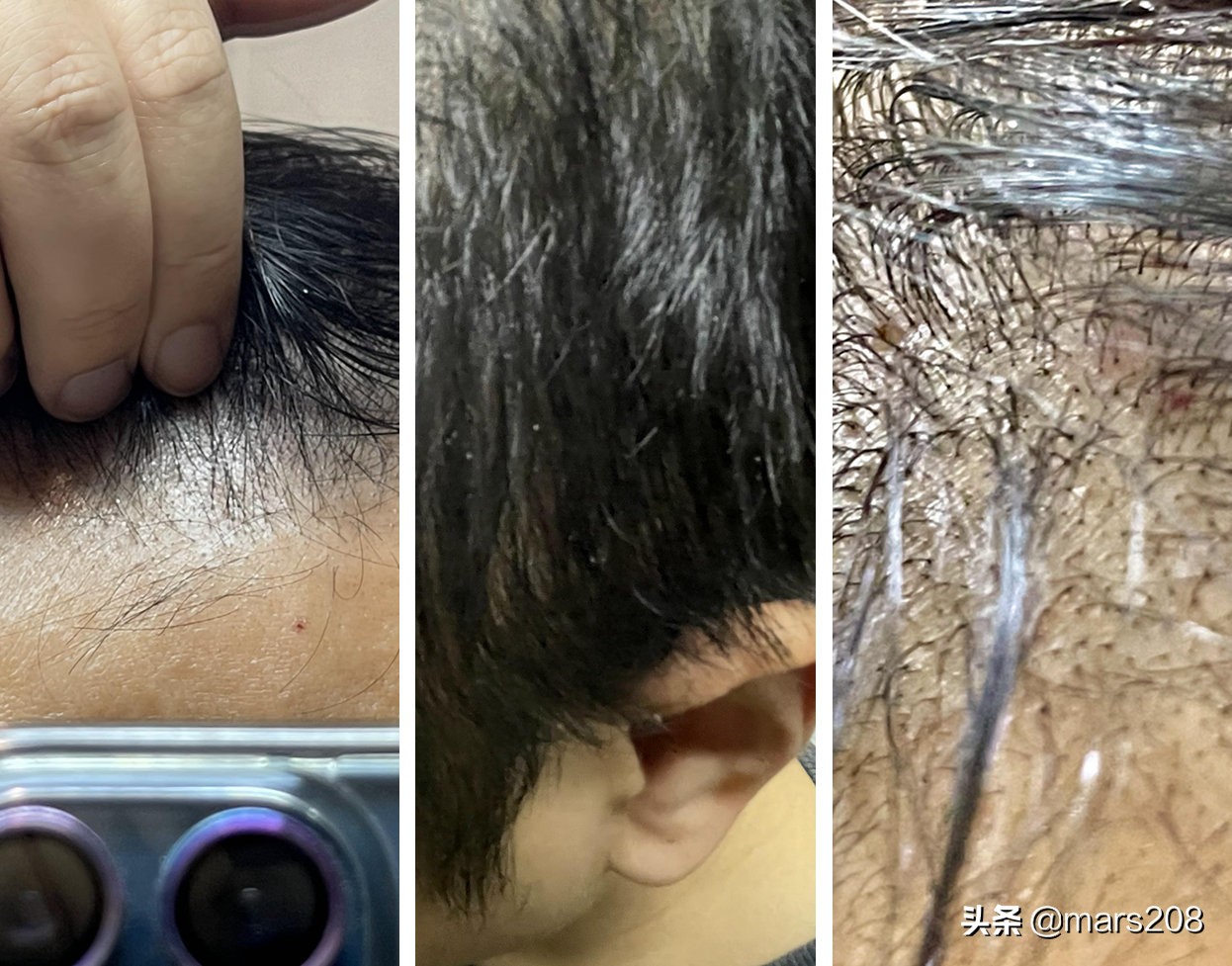 控油防秃头洗发水推荐,修护受损发质防脱洗发水推荐