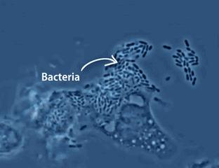 NK细胞是抗病毒治疗的天然*器武**，用来对抗新冠、流感以及HIV等