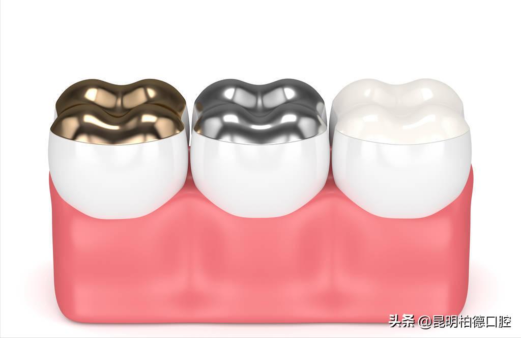烤瓷冠牙龈变黑,全瓷冠边缘发黑怎么回事