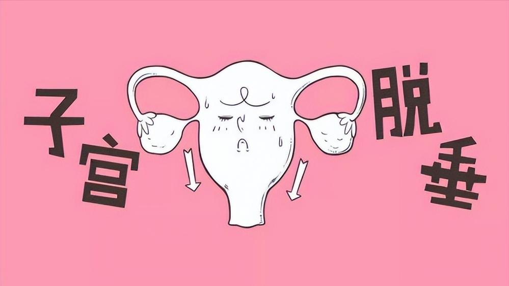 女人的子宫往下掉怎么治疗,女人老了子宫脱落的症状