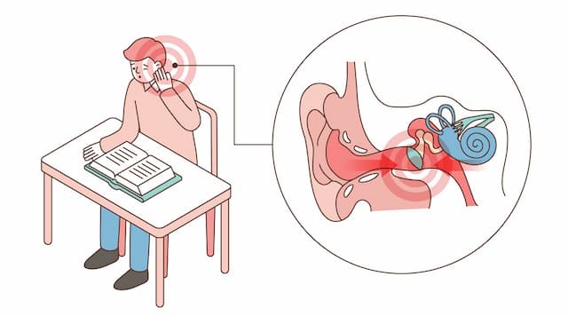 中耳炎耳朵流脓怎么治,孕妇中耳炎耳朵流脓怎么办