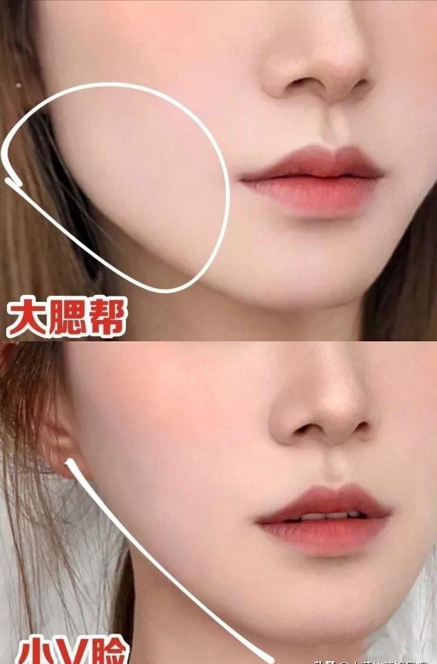 发腮和塌腮哪个更显老,发腮真的显老吗