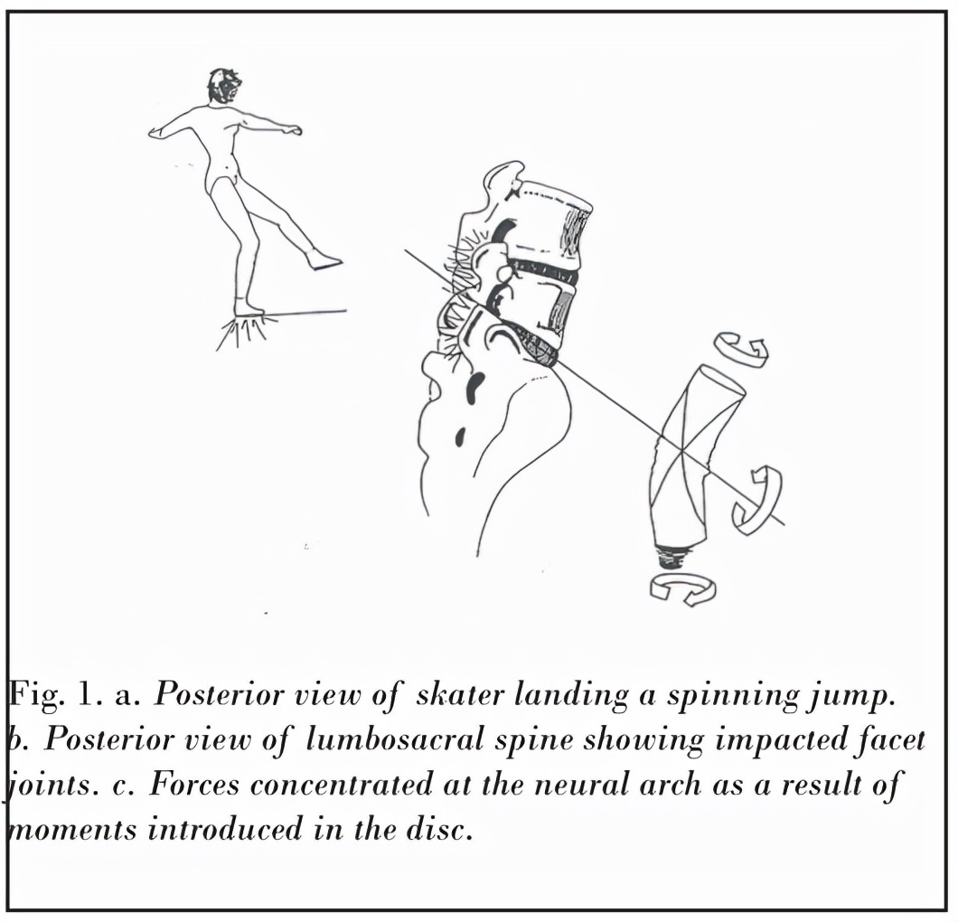 华尔兹伤膝盖,冰上芭蕾受伤