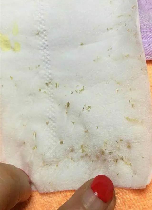 去鼻子上的黑头最好的方法,去鼻子上黑头的有效方法