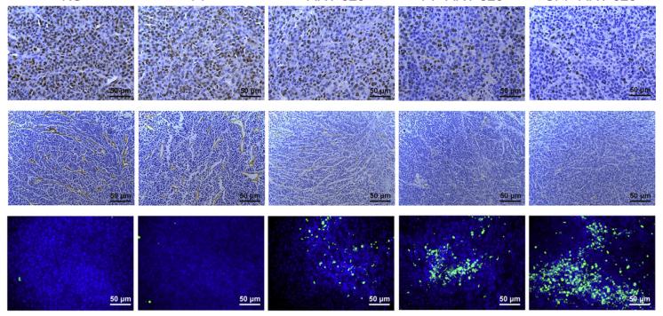 四川大学：一种BRD4PROTAC纳米片可以有效治疗胶质瘤