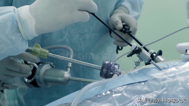 麦先生，我要对你说声抱歉，肠癌手术后让你辛苦了