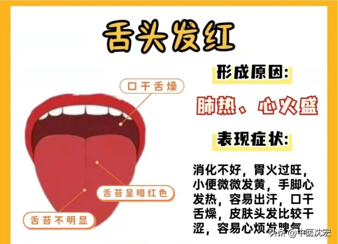 中医教你看舌头得知身体表现,中医看舌头舌苔图谱