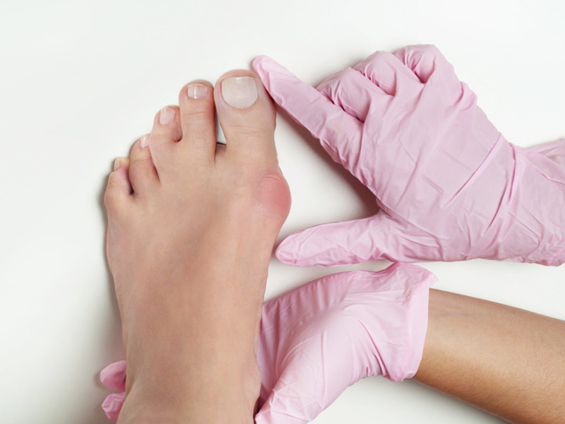 大拇脚趾甲长歪了还能矫正吗,大脚趾甲长歪