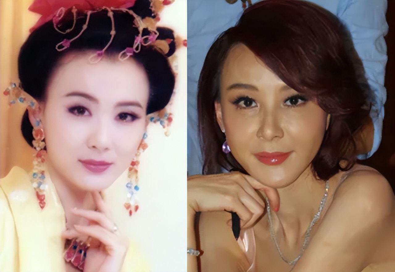 台湾艺人整形记：削骨换脸小意思，嫁给美容医师能终身保修