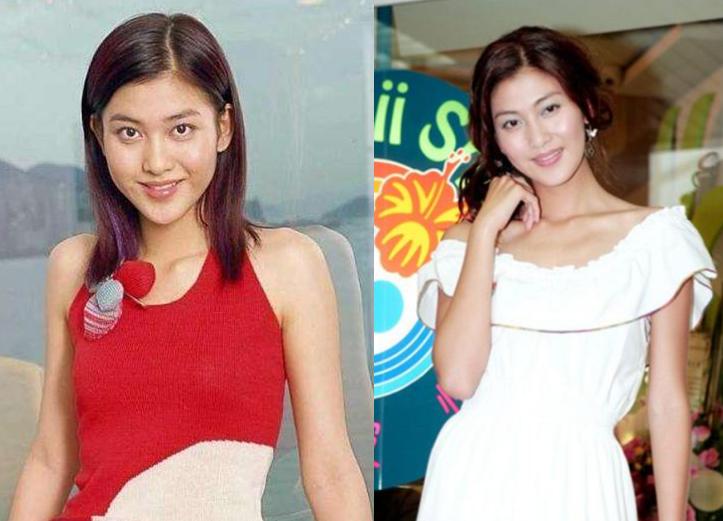 有一种倔强叫做没整容,有种倔强叫不承认整容