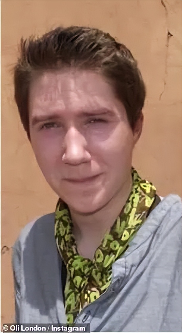 白人网红整容韩国人,白人网红整容18次