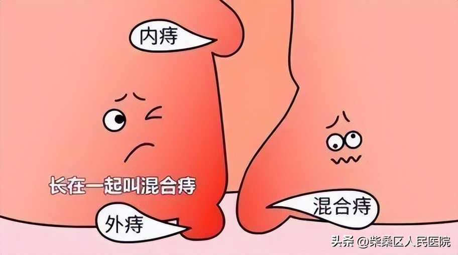 肛肠科女大夫,肛肠科女专家