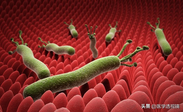 幽门螺杆菌治疗失败了还能治好吗,幽门螺杆菌杀菌失败多久杀第二次