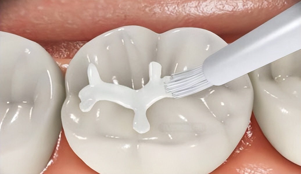 @所有家长:十个孩子九个蛀牙?只要做到这两点就可以避免