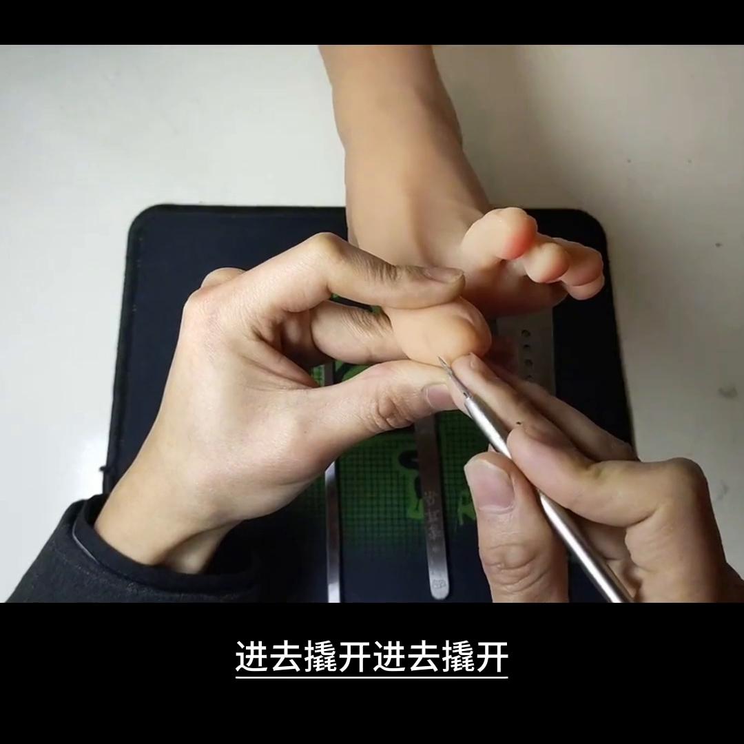 钎刀使用教程#修脚