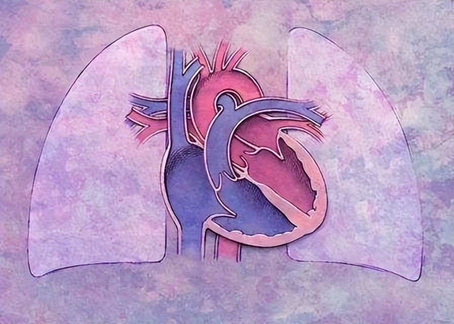 速效救心丸对急性心脏病有效么,速效救心丸对冠心病有效吗