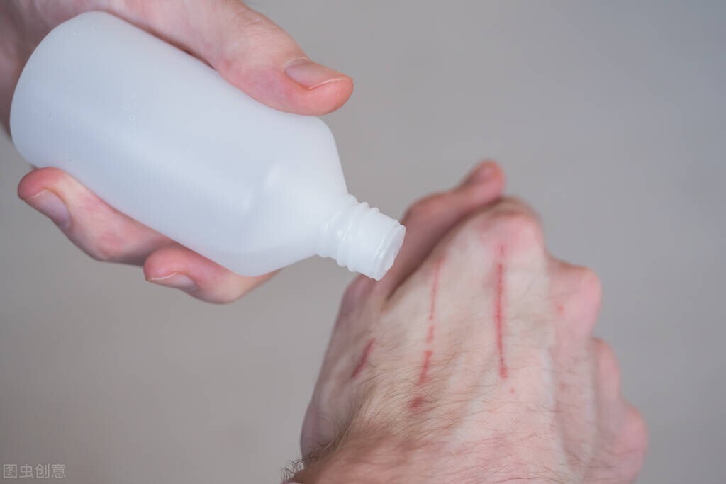 过氧化氢对伤口有腐蚀吗,过氧化氢会导致伤口发炎吗