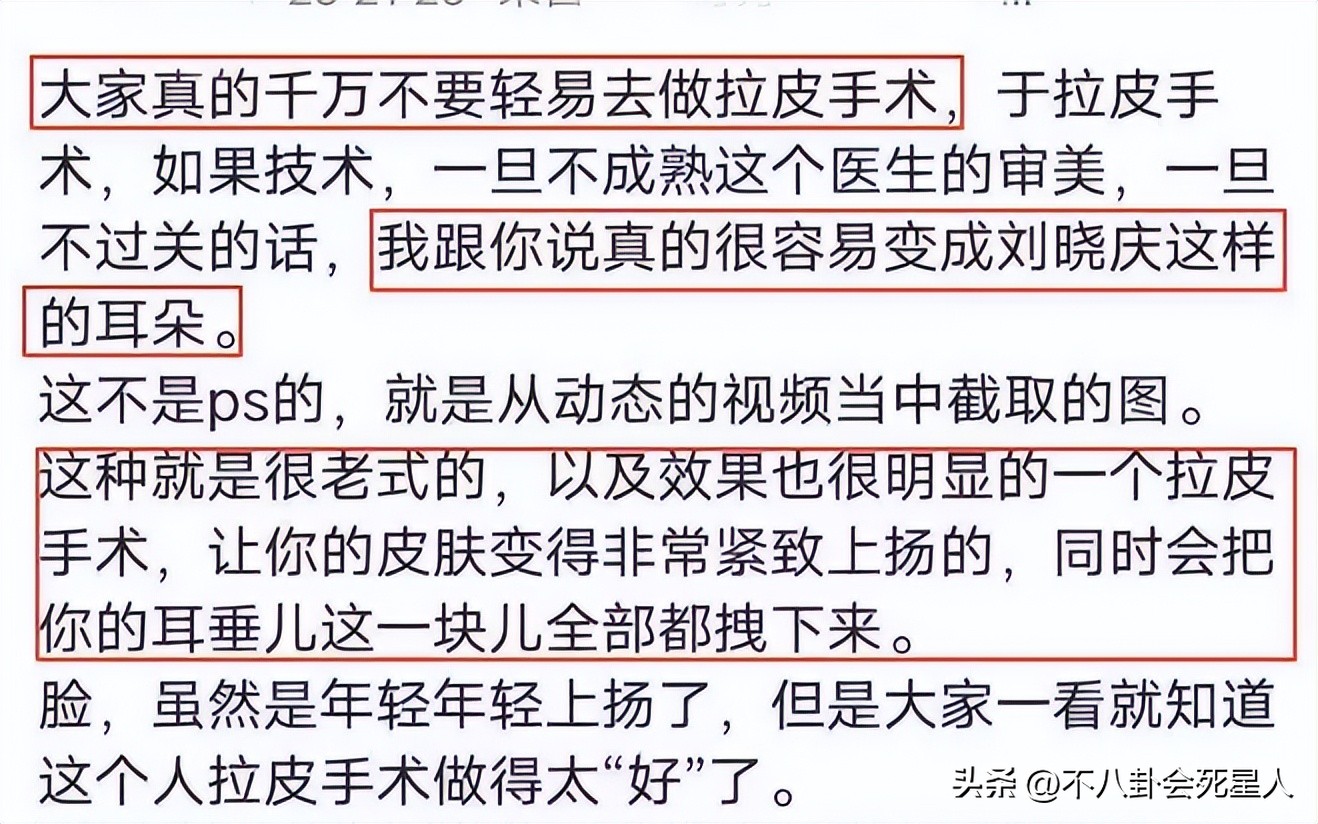 拉皮的女明星后遗症,拉皮失败的明星