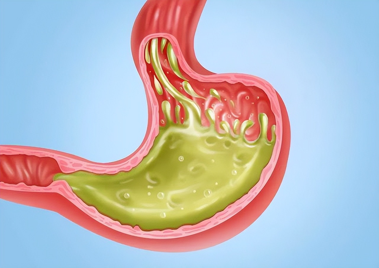 饭后总感觉反酸、烧心，应该怎么处理？3个建议或要听一听