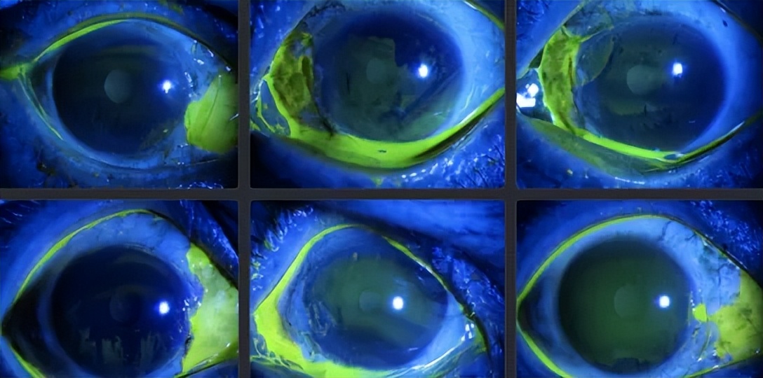 医学影像目标检测框架,开源数据集目标检测