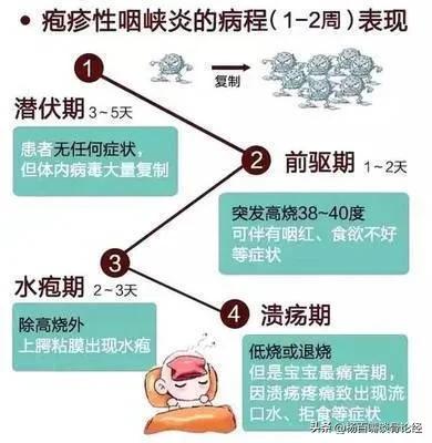 咽峡炎困扰？试试这些中医疗法：安全有效，能让孩子快速恢复健康
