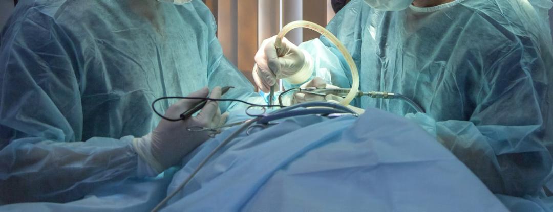 卵巢囊肿微创手术后能清理干净吗,腹腔镜下卵巢囊肿切除术的步骤