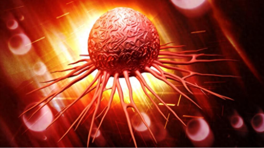 高温治疗是否可以杀死癌细胞,高温杀死癌细胞吗是真的吗