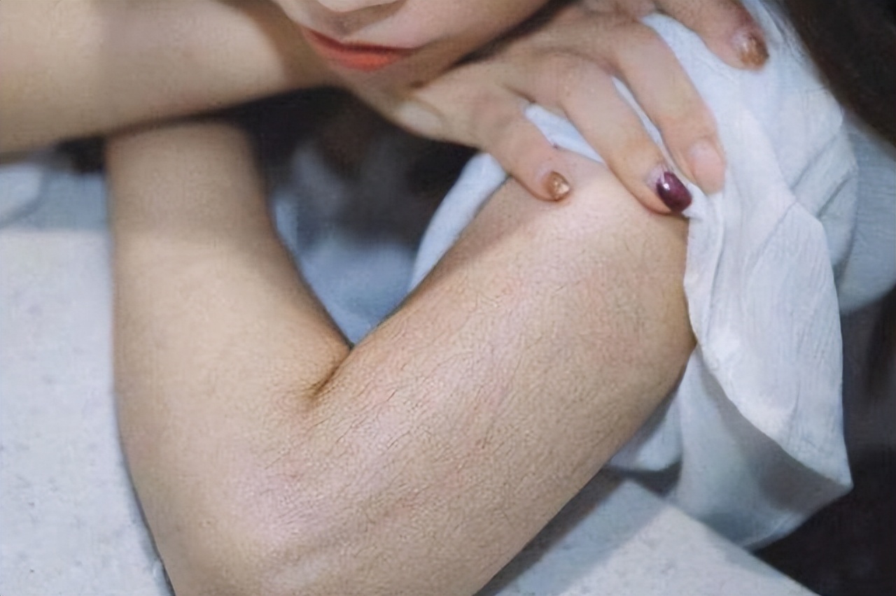 女性体毛重怎么去除,体毛旺盛该怎么减少体毛