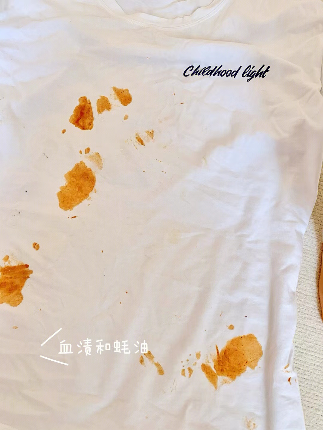 衣服上溅到油污怎么办,啫喱水加牙膏可以去除衣服油污吗